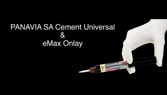 Case Study - PANAVIA SA Presentation